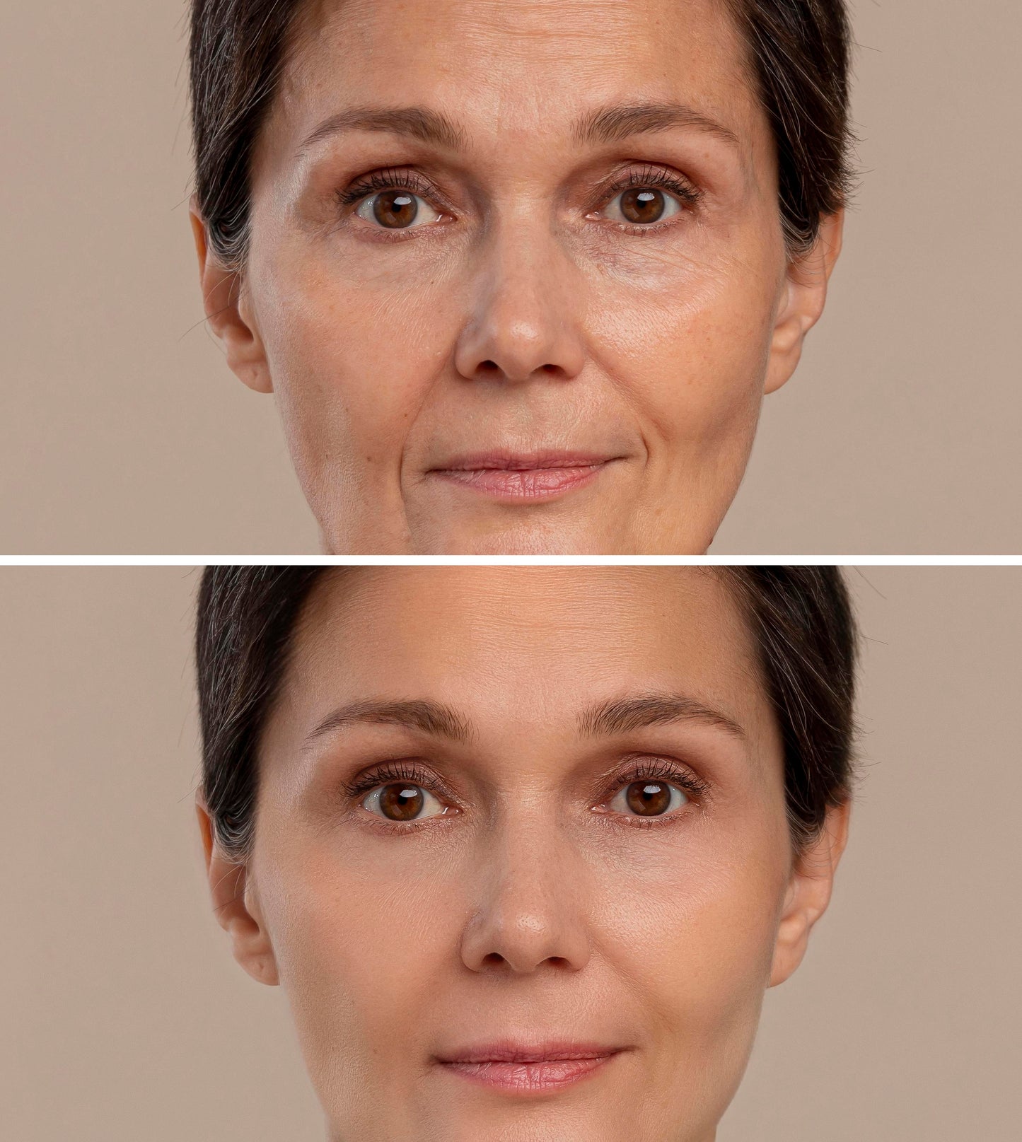 BETTER: Lifting And Tightening Face Introducer